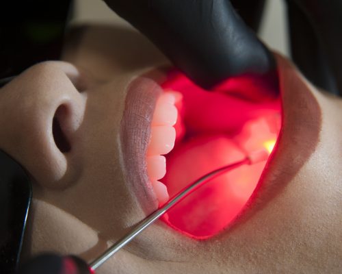 tratamento de laserterapia